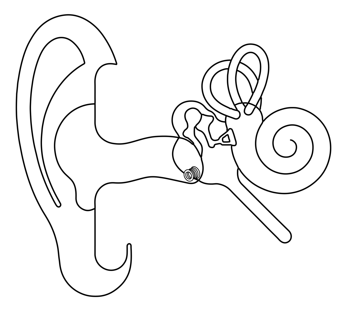 Line-art diagram of the outer, middle and inner ear showing a grommet (ventilation tube) placed through the eardrum.
