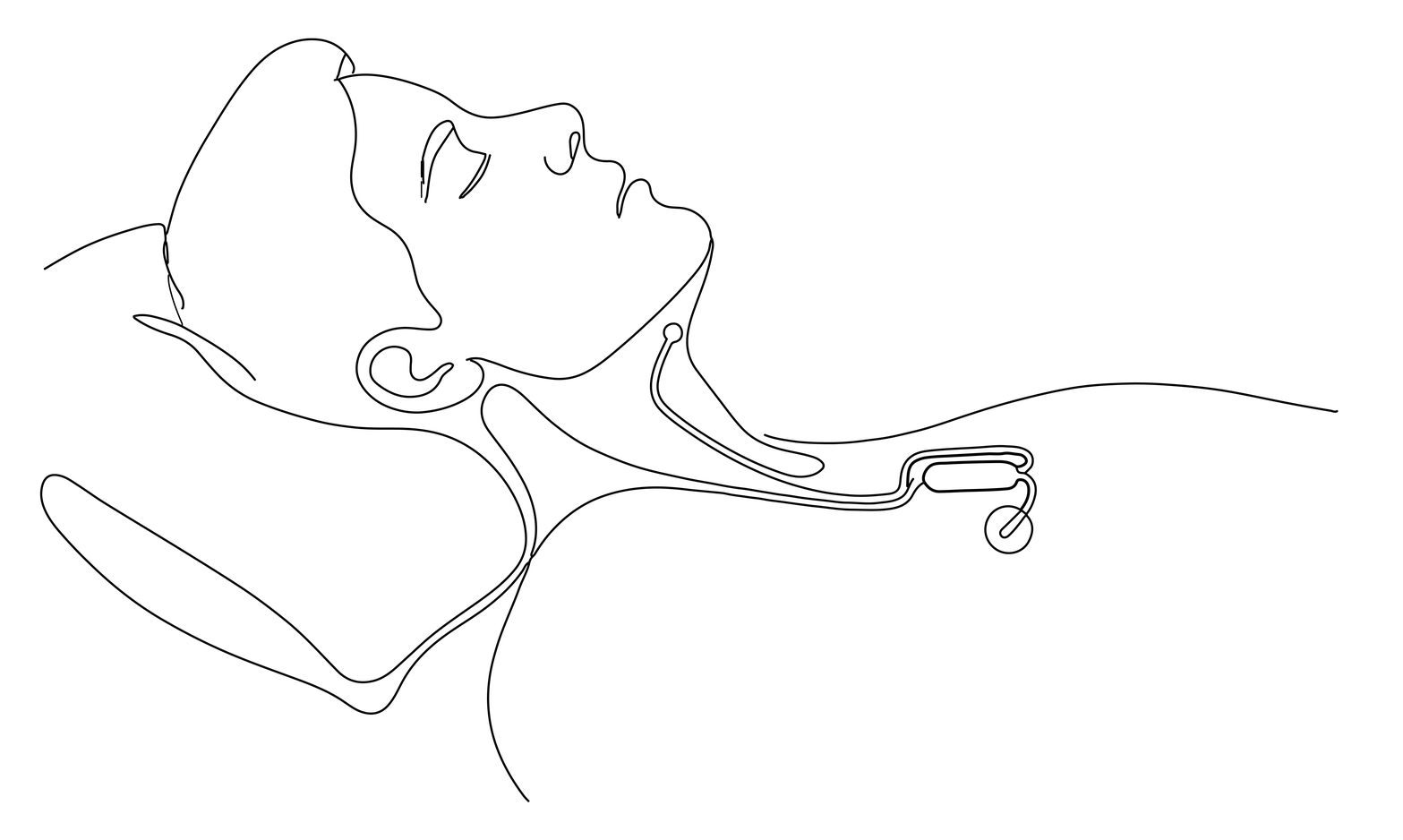 Line-art illustration of a person sleeping, showing the position of the Inspire hypoglossal nerve stimulator implant that keeps the airway open during sleep.