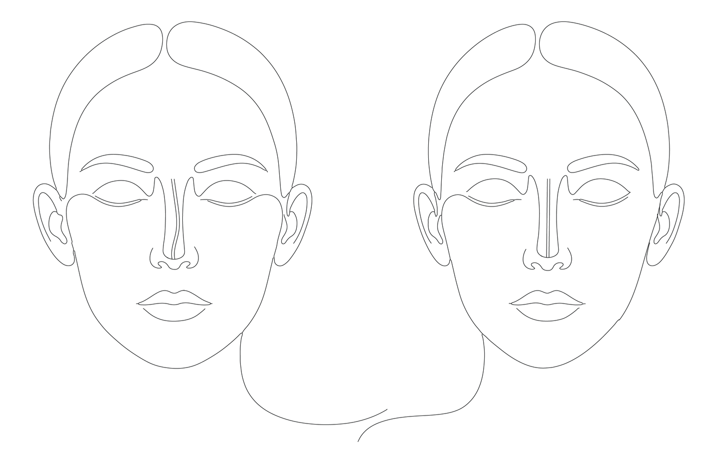 Line-art diagram of two faces comparing a deviated nasal septum on the left with a straightened septum after septoplasty on the right.